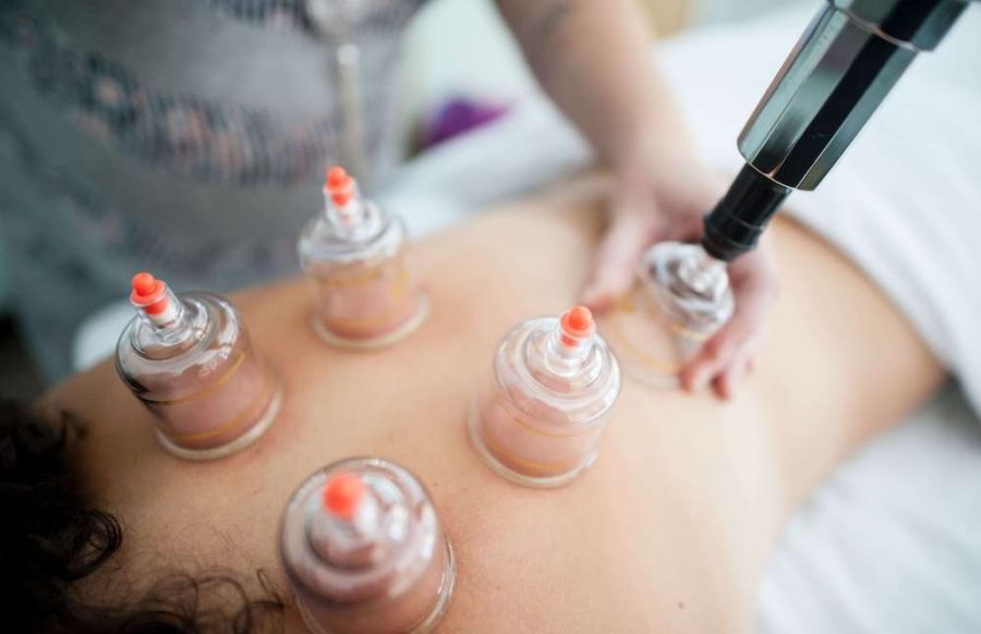 cupping procedure on back; healthcare in Malaysia 