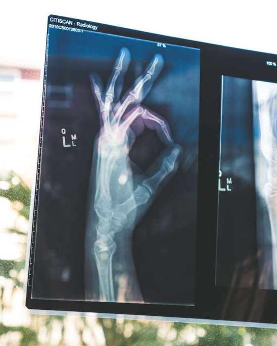 xray of ok sign: healthcare in malaysia